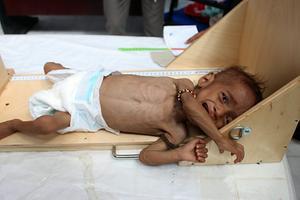 Het is hoog tijd dat de internationale gemeenschap de honger in Jemen serieus aanpakt. beeld AFP, Essa Ahmed