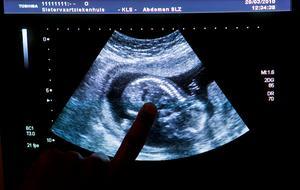 Een echo. beeld ANP