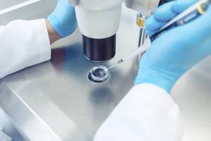 Spreken over kiembaangentherapie kan niet zonder opnieuw klassieke vragen te stellen over de beschermwaardigheid en onaantastbaarheid van een embryo. beeld iStock