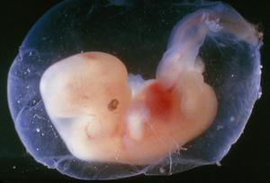 Foto van een embryo, vijf tot zes weken na de bevruchting. beeld Science photo library