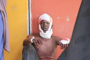 Een gewonde man zit buiten het Medina Hospital in Mogadishu, Somalië. beeld AFP