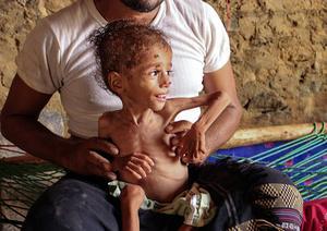 Moaz Ali Mohammed (2) een ondervoed kind in Jemen. beeld AFP