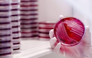 De Clostridium difficile bacterie (de ziekte verwekker waarvoor de poep of fecestransplantatie gegeven wordt) in een anaerobekast bij de eerste Nederlandse Donor Feces Bank (NDFB), speciaal voor poeptransplantaties. Deze bank is gevestigd in het Leids Universitair Medisch Centrum (LUMC) en is bedoeld voor mensen met darmaandoeningen. ANP Robin van Lonkhuijsen